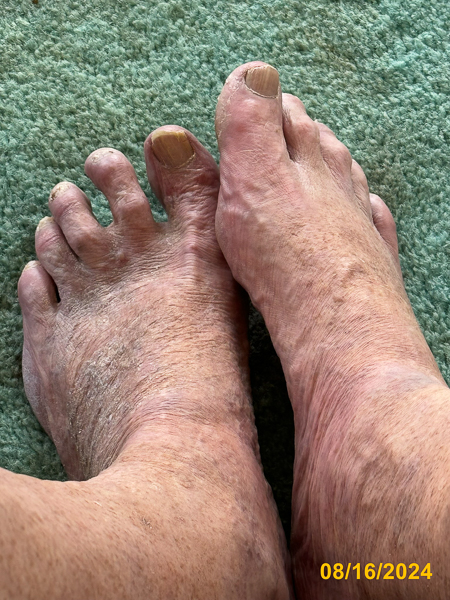 0277